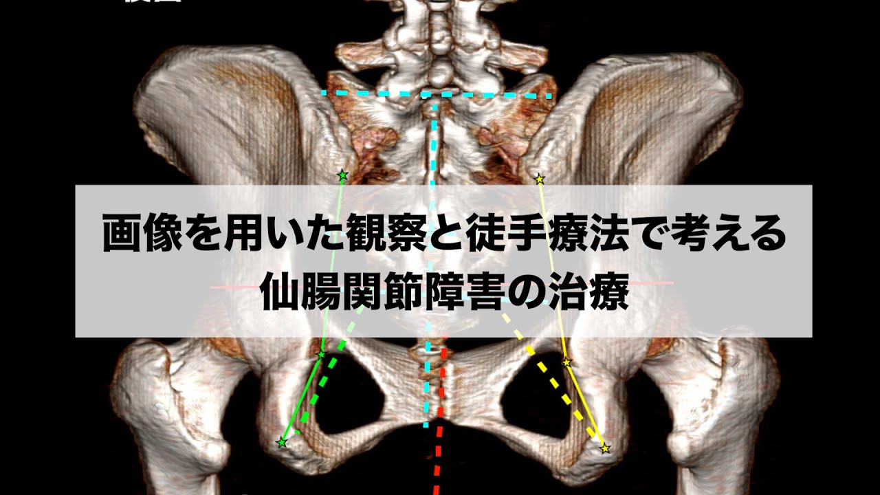 仙腸関節障害│にしむら治療院 針・灸・徒手療法