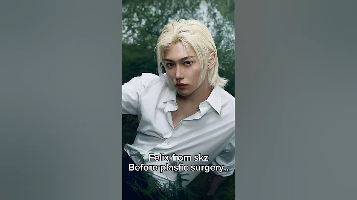 Before and after plastic surgery.. #felix #straykids #kpop #funny #alien