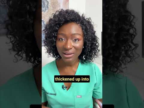 Video: Moet mijn menstruatie klonterig zijn?