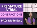 Premature Atrial Contractions (PACs) Quiz