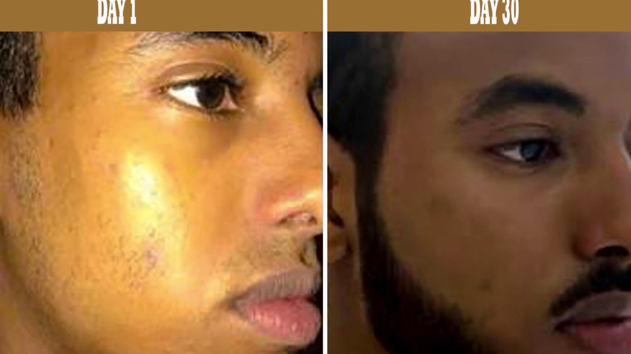 HOW TO GROW BEARDS FAST NATURALLY - YouTube