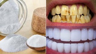 सिर्फ 2 मिनटों में पीले दांतों को मोती की तरह चमका देगा ये सबसे अद्भुत घरेलु नुस्खा | Teeth Whiten