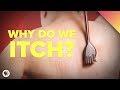 Why Do We Itch?