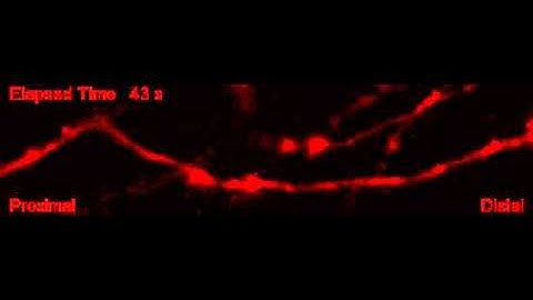 Live imaging of axonal transport in hippocampal neurons