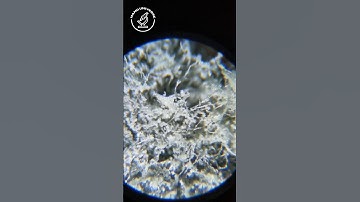 Moldy Apple Under the Microscope #microscope #apple