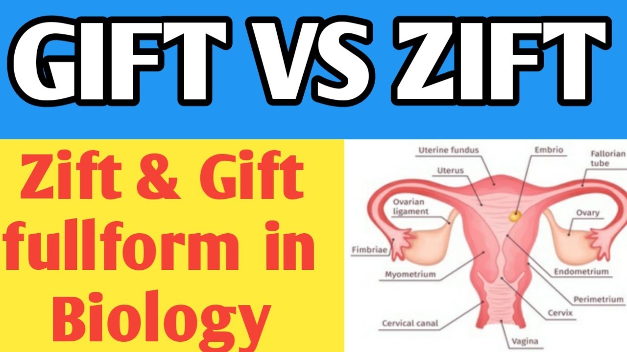 Details more than 115 gift and zift difference best