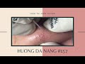 #157 | Huong Da Nang