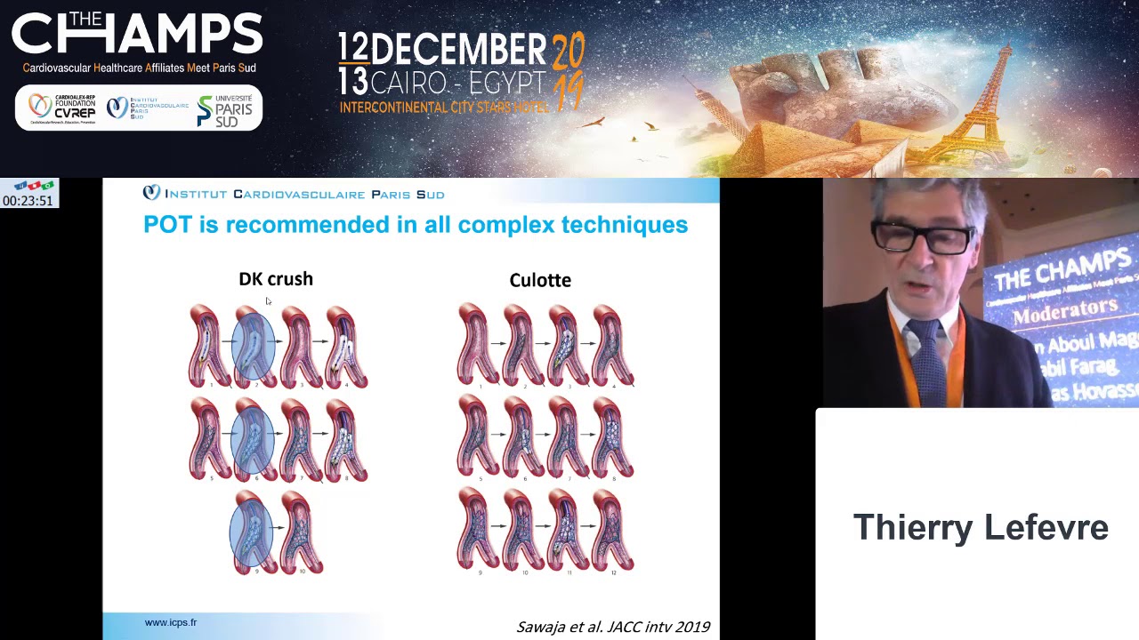 POT and kissing balloon technique are mandatory in all bifurcation lesions YouTube