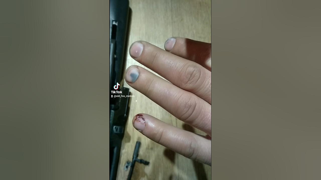 Что делать, если у вас поломался ноготь наполовину: советы для первой помощи Тен