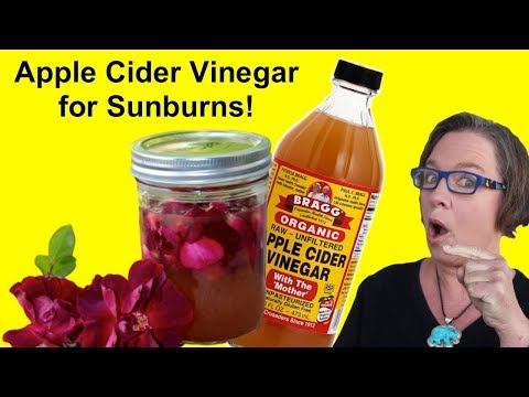 Video: Cuka Apple Cider Untuk Penjagaan Sunburn?