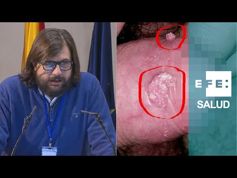 Vídeo: Infección Por Levadura Del Pene: Síntomas, Tratamiento Y Más