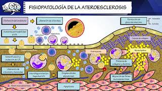 FISIOPATOLOGIA DE LA ATEROESCLEROSIS || Morfofisiología