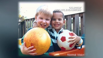 Bionic eye to restore vision for blind