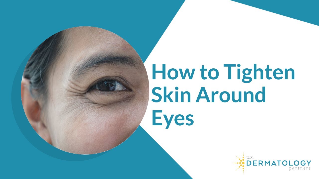How to Tighten Skin Around Eyes - Reduce Wrinkles