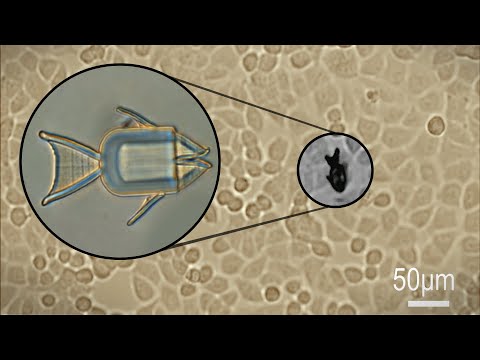 Shape-Morphing Microrobots Deliver Drugs to Cancer Cells