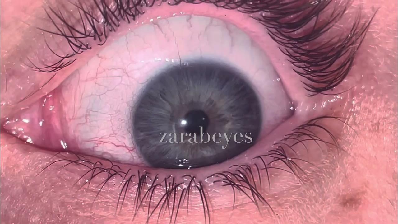 Eye mucous fishing…IT IS MASCARA RESIDUE NOT A WORM 🙈🙈 YouTube