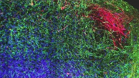 Replacing animal testing with cultured human cells