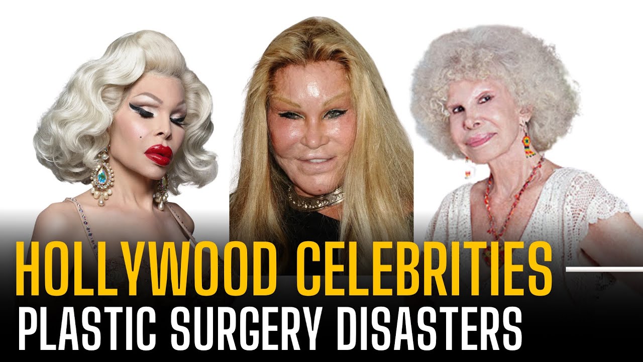 17 Celebrity BeforeAndAfter Plastic Surgery Disasters YouTube