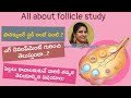 ఫాలిక్యులర్‌ స్టడీ స్కాన్‌ అంటే ఏంటి..? | Follicle Development and Ovulation | Dr Swapna Chekuri