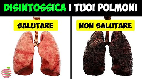 Dove sono le branchie dei pesci?