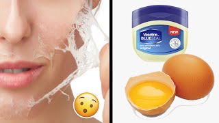 Use Vaseline And Egg, See How Your Face Will Change.