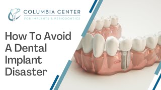How To Avoid A Dental Implant Disaster