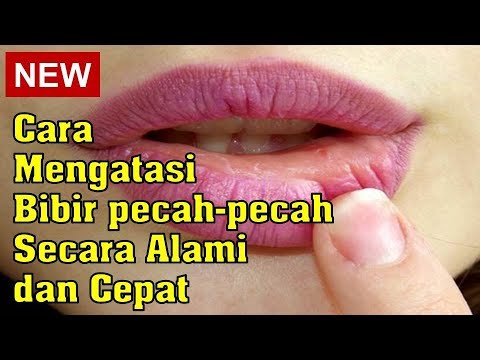 cara-mengatasi-bibir-pecah-pecah-secara-alami-dan-cepat