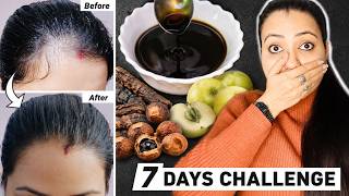 3 Traditional HAIR GROWTH CHALLENGING Remedies That Deserve a Comeback! |Hair Mask, Oil & Seed Mix