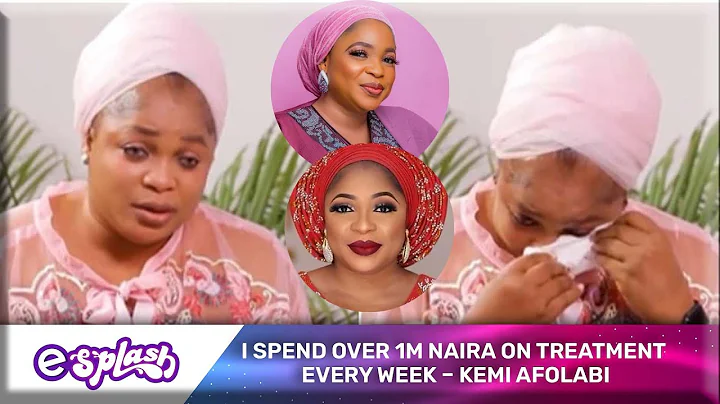 'I Have Only 5 Years To Live', Kemi Afolabi Opens Up About Battle With Lupus