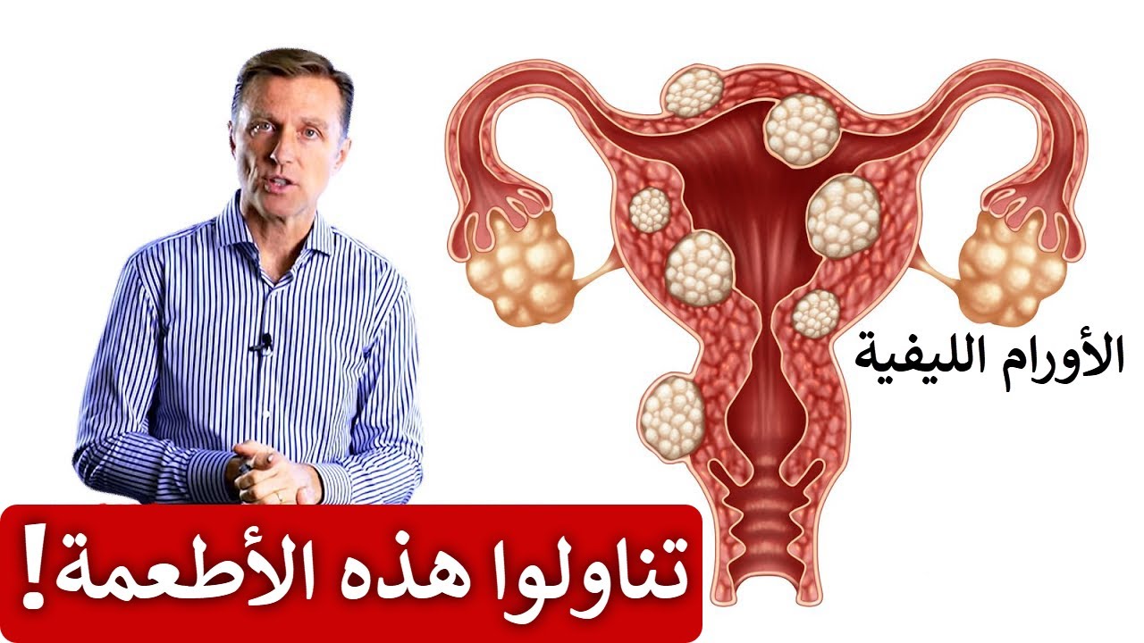 9 أطعمة تساعد في تقليص الأورام الليفية!