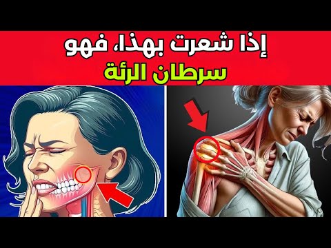 10 علامات صادمة لسرطان الرئة يتجاهلها الكثيرون العلامة رقم 7 تجاهلها الأطباء لسنوات