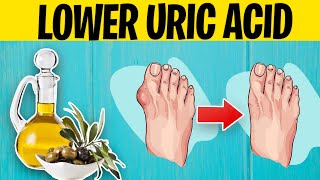 How To Lower Uric Acid Naturally & Prevent Gout