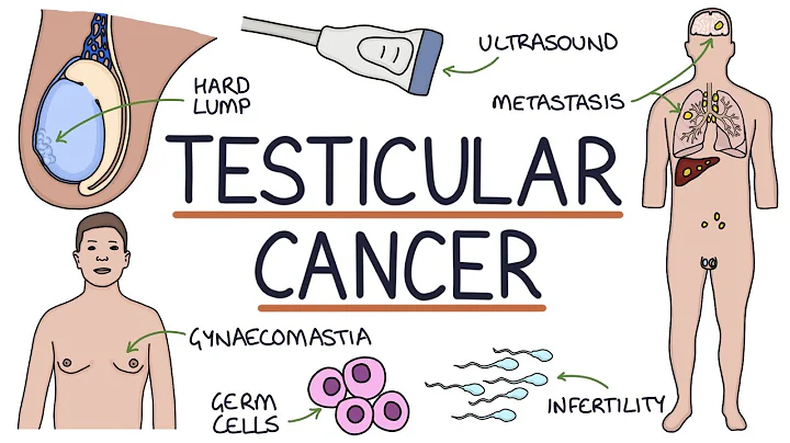 Understanding Testicular Cancer - DayDayNews