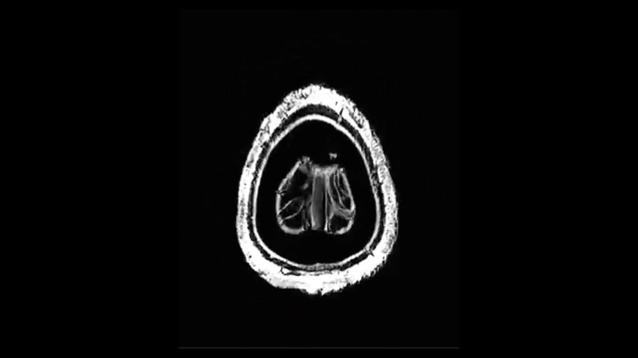 High resolution 0.7mm isotropic 3D MP-RAGE at Signa 7T