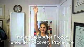 LEARN THE TRUE CAUSE &amp; CURE OF ADHESIVE CAPSULITIS FROZEN SHOULDER