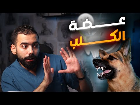 عضة الكلب والطريقة الصحيحة للتعامل معها مرض السعار 