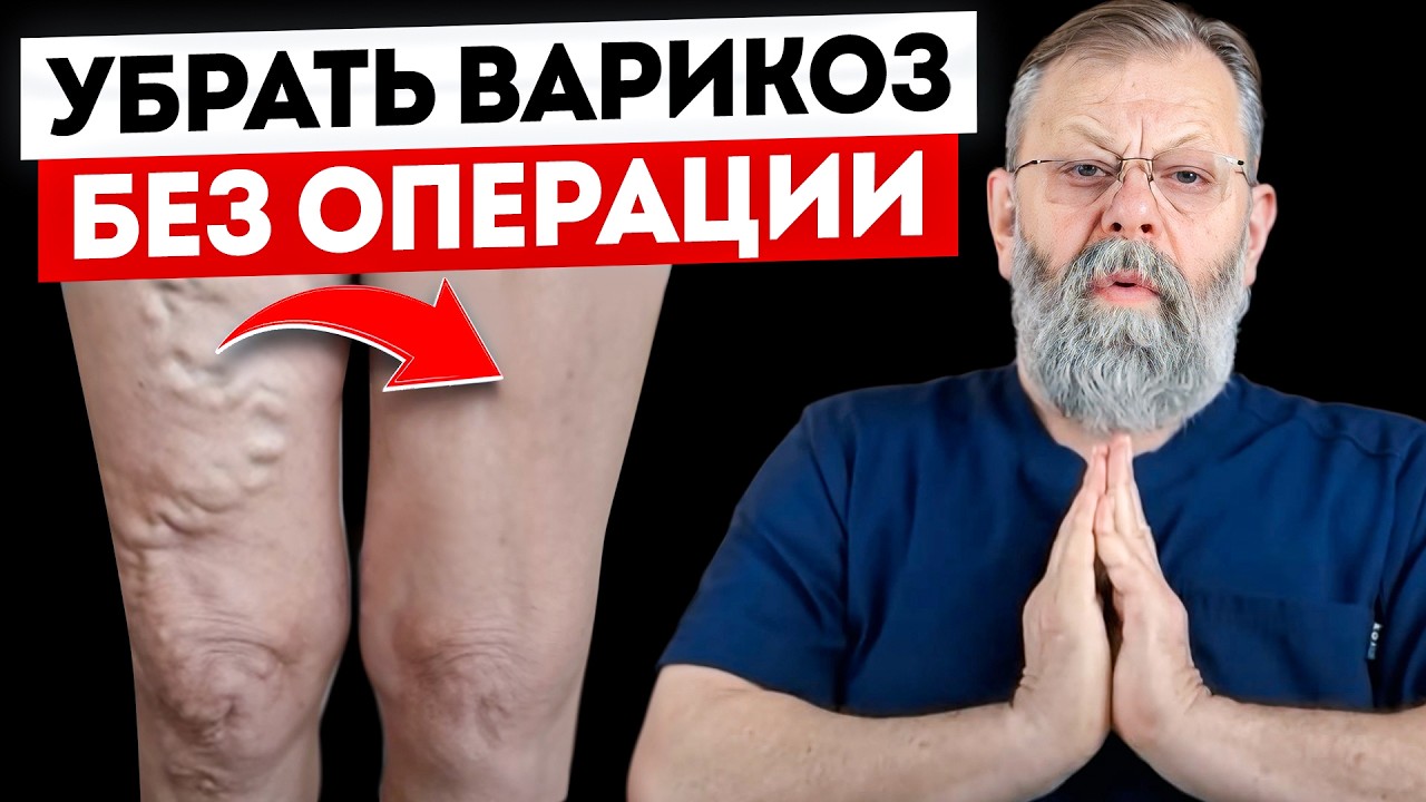 Варикозное расширение вен и совместимость при беге