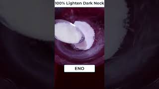 lighten dark neck