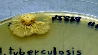 World TB Day - Drug-resistance in TB (part 3 of 6)