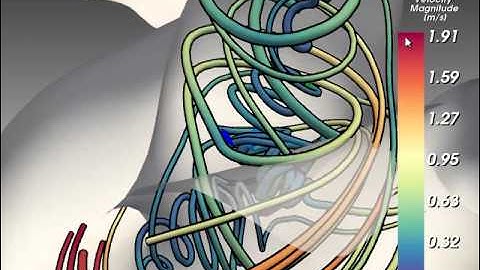 Steffen Oeltze: Blood Flow Clustering in Cerebral Aneurysms