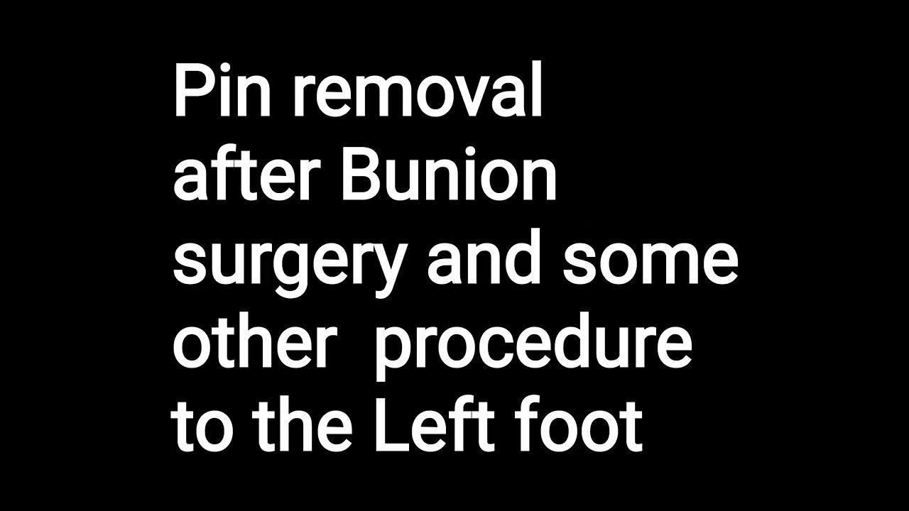Removing Pins From My Left Foot After Bunion Surgery YouTube how-to-bandage-a-toe-after-surgery-by-miss-foot-fixer-youtube