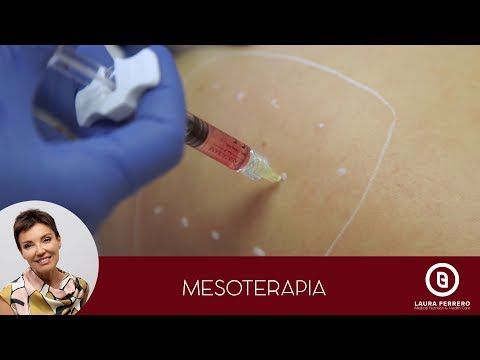 Video: Mesoterapia Facciale - Descrizione, Controindicazioni, Recensioni