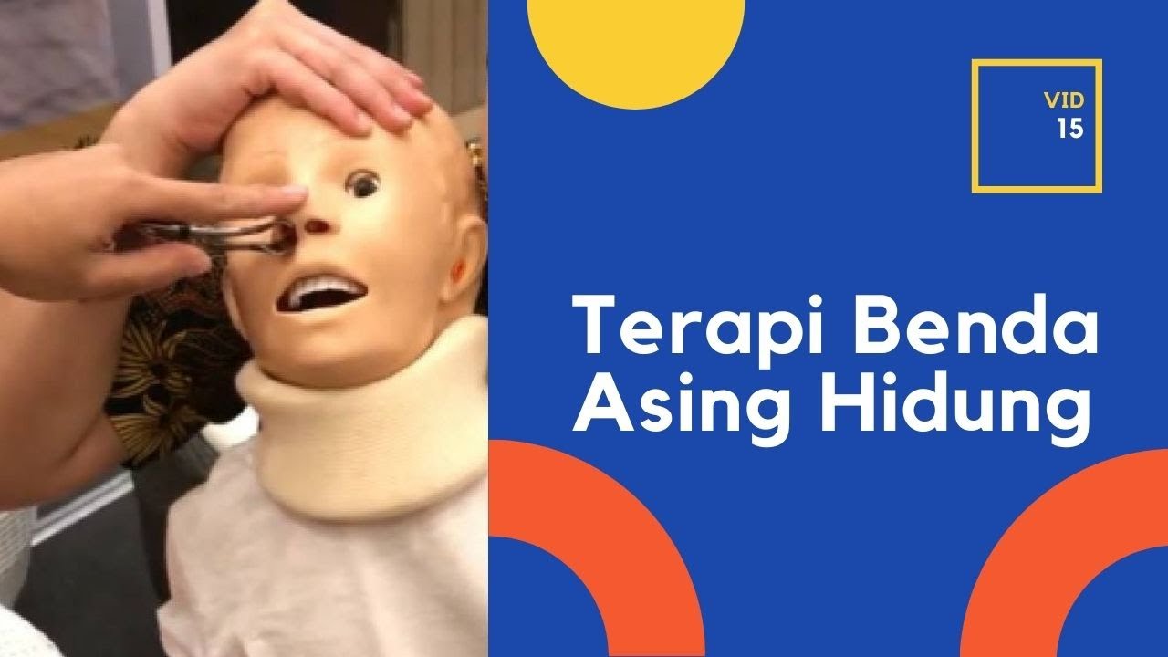 Terapi Benda asing di hidung (Corpal / corpus alienum cavum nasi)