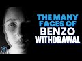 The many faces of benzo wit.rawal