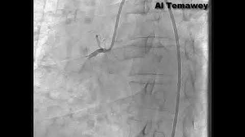 perfect hard Pci to old Rca C.T.O