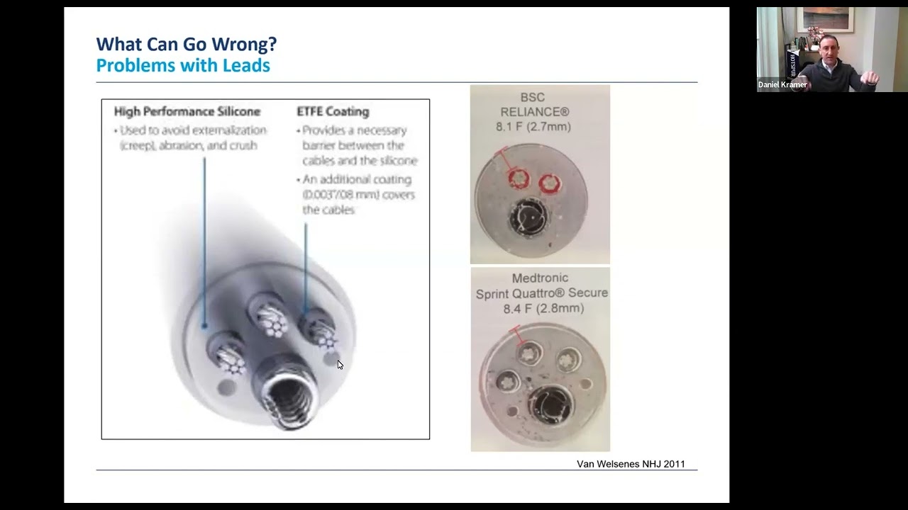 Failure and Adverse Events Related to Implantable Medical Devices: Risks and Responsibilities