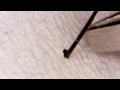 ？００１　毛根　ひっつき動画