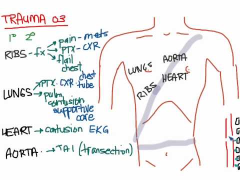 Video: Chest Trauma - Bruise And Fracture Of The Chest