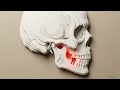 The "Audio Anchor" Strategy: Living with Tinnitus & Trigeminal Neuralgia