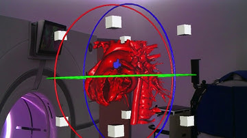 RadHA Augmented Reality app: Latest Build Preview!